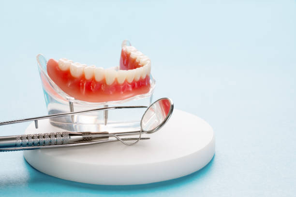 Full Mouth Reconstruction in New London, OH
