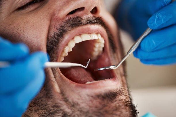 Emergency Dental Services in New London, OH